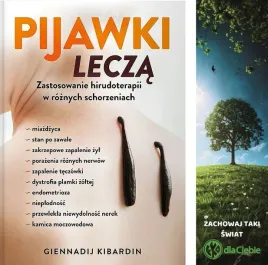 pijawki-lecza-zastosowanie-hirudoterapii
