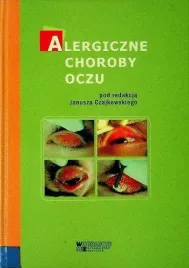 alergiczne-choroby-oczu-red-janusz-czajkowski