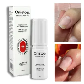 onycholiza-stop-olejek-do-paznokci-przeciw-onycholizie-notd-onistop-15-ml