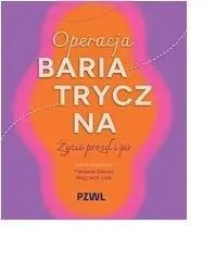 operacja-bariatryczna-zycie-przed-i-po
