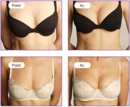 zel-sprej-perfect-bust-gel-150ml