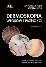 dermoskopia-wlosow-i-paznokci-a-sechi-a-tosti