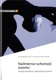 nadmierna-ruchomosc-stawow