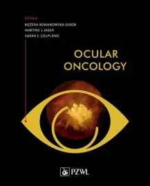 ebook-ocular-oncology