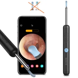 otoskop-z-kamera-bebird-r1-czarny