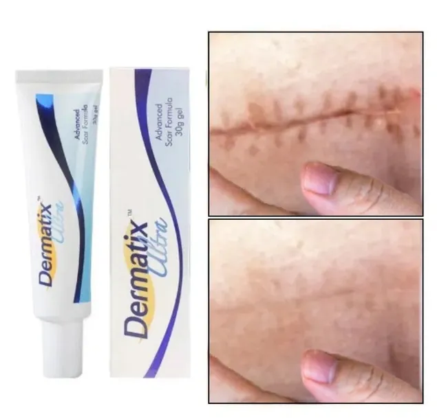 Dermatix Ultra Silikonowy Żel Do Leczenia i Zapobiegania Blizn 15g