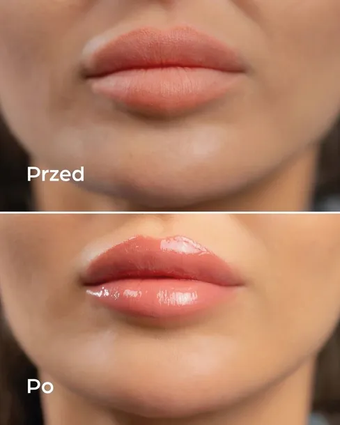 hdrey-laboratories-raspberry-mousse-blyszczyk-do-ust-marka-hdrey