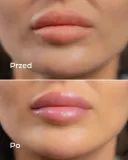 hdrey-laboratories-blueberry-splash-blyszczyk-do-ust-marka-hdrey