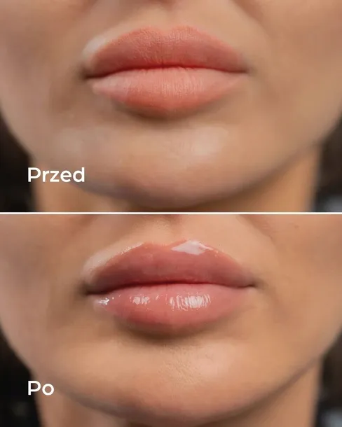 hdrey-laboratories-bubble-vanilla-blyszczyk-do-ust-marka-hdrey