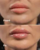 hdrey-laboratories-bubble-vanilla-blyszczyk-do-ust-marka-hdrey