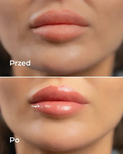 hdrey-laboratories-raspberry-mousse-blyszczyk-do-ust-marka-hdrey