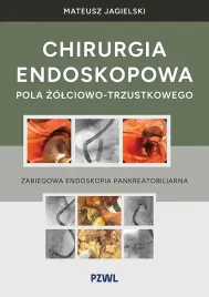 chirurgia-endoskopowa-pola-zolciowo-trzustkowego-zabiegowa-endoskopia-pankreatobiliarna-mateusz-jagielski