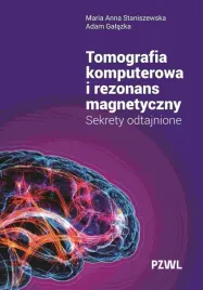 tomografia-komputerowa-i-rezonans-magnetyczny