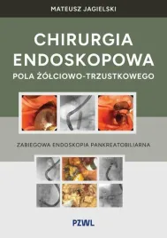 chirurgia-endoskopowa-pola-zolciowo-trzustkowego