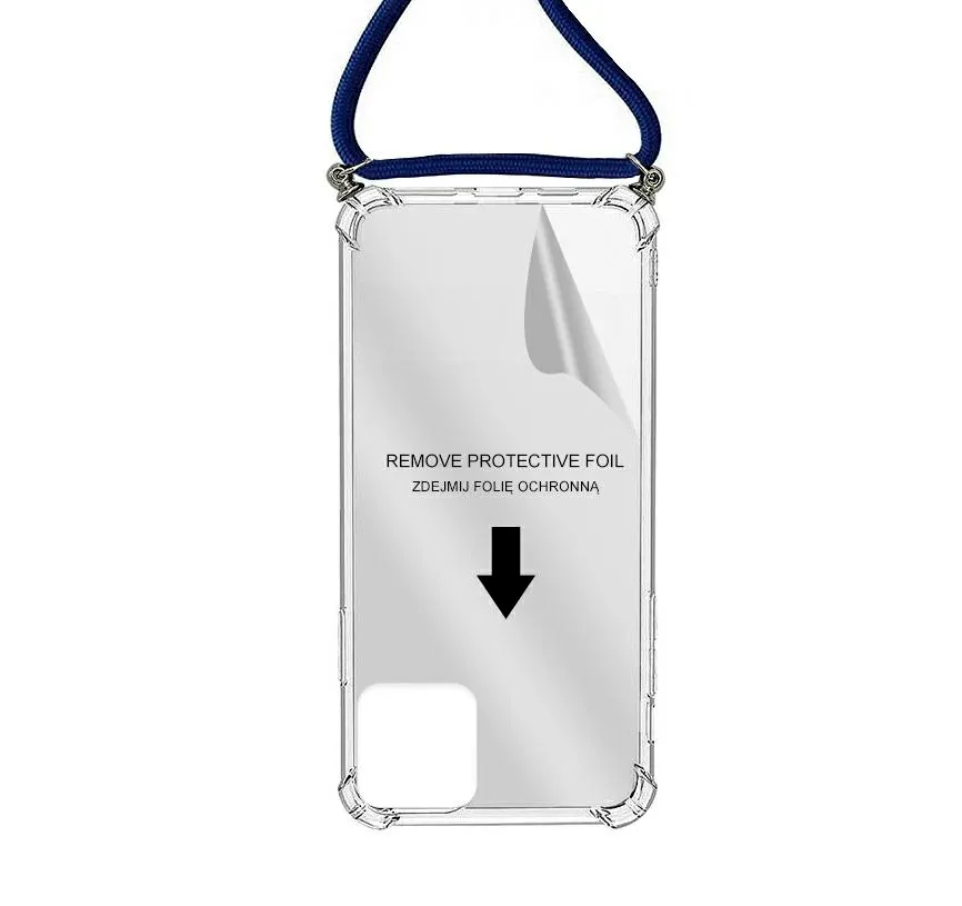 rope-case-iph-x-xs-blue