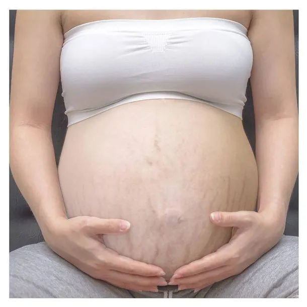 krem-przeciw-rostepom-natal-anti-stetch-marka-mustela