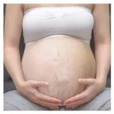 krem-przeciw-rostepom-natal-anti-stetch-marka-mustela