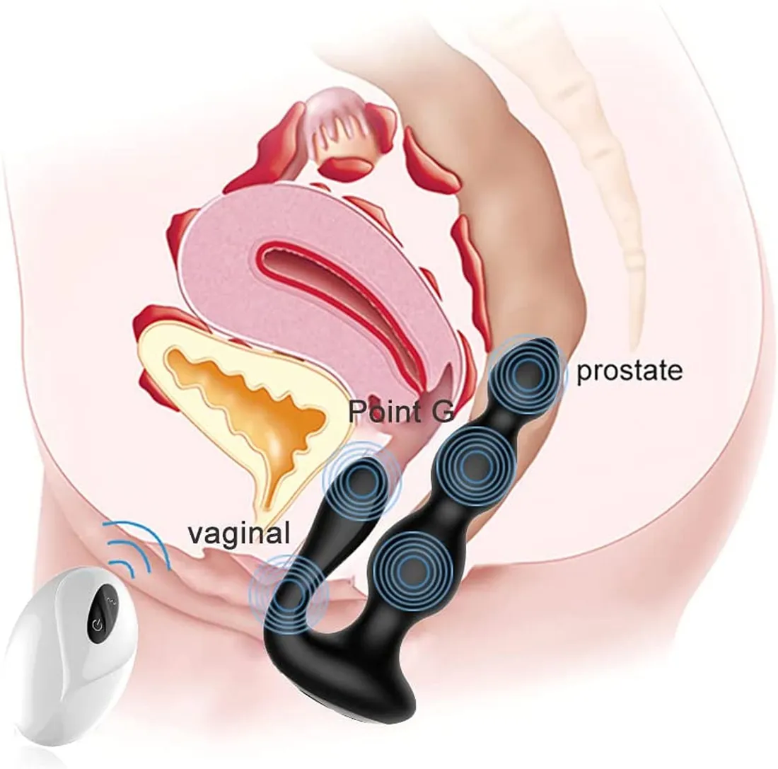 remotesilicone-analbeads