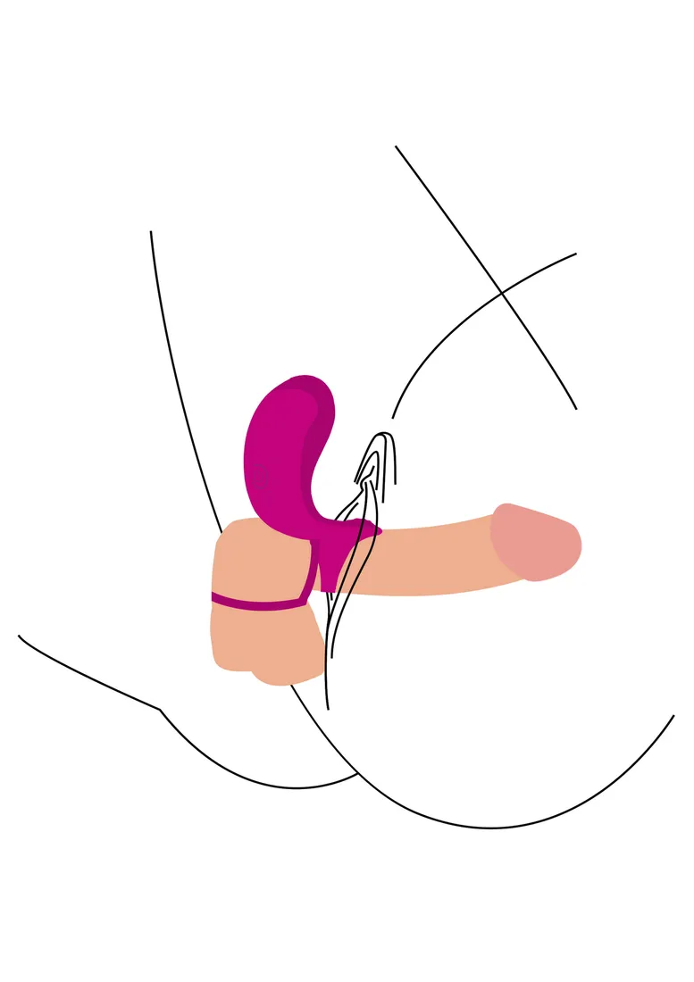 couples-stimulator-ring