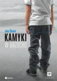 kamyki-w-brzuchu