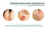 beyond-derma-roller-dermapen-walek-regenerujacy-marka-inna-marka-zasilanie-akumulatorowe-bateryjne-sieciowe-sieciowo-akumulatorowe-brak
