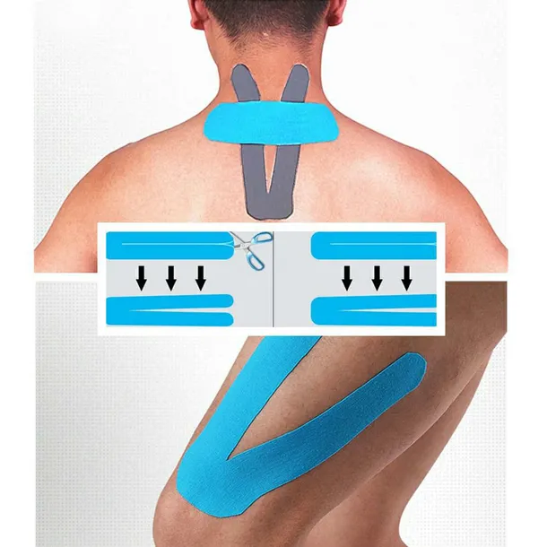tape-tejpy-kinesiotaping-tejp-tasma-rodzaj-elastyczne