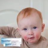 bepanthen-sensiderm-krem-20g