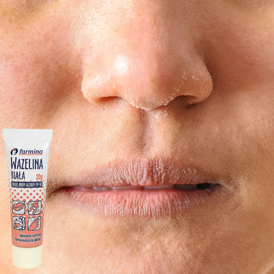 wazelina-biala-krem-20g