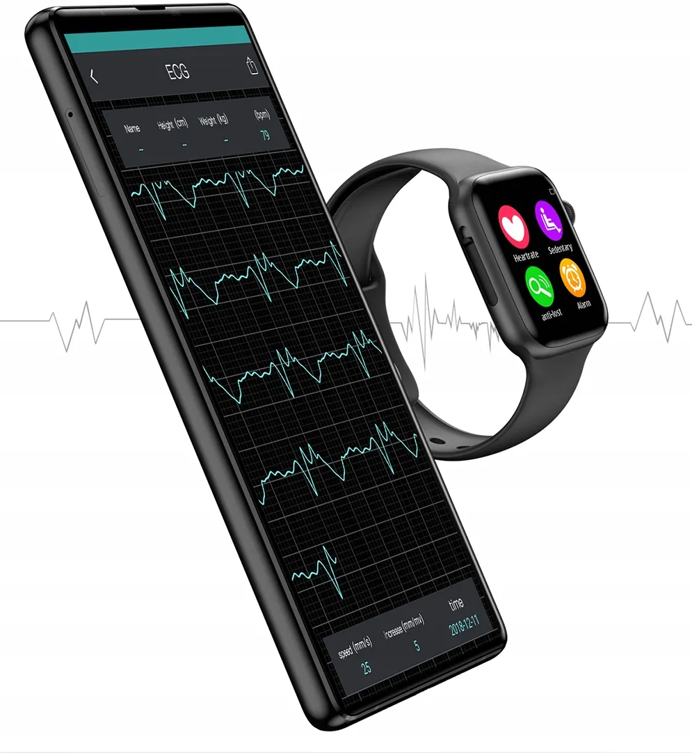 smartwatch-do-xiaomi-redmi-note-7-8-mi-9t-pro-stan-nowy