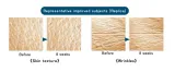 aliness-proskin-elastin-complex-hialuron-complex-2-x-60-caps