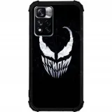 etui-antishock-do-redmi-note-11-pro-plus-5g-wzory