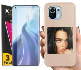 super-etui-do-xiaomi-mi-11-5g-wzory-3x-szklo-3szt