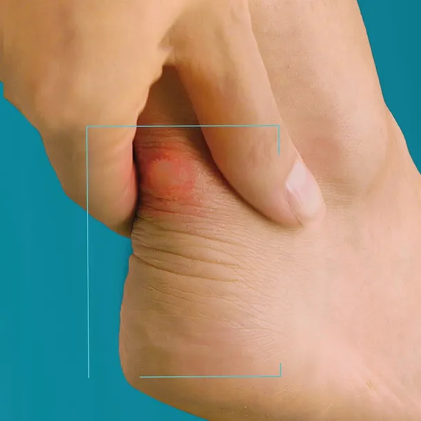 compeed-plastry-na-pecherze-mix-5-sztuk-certyfikat-ce