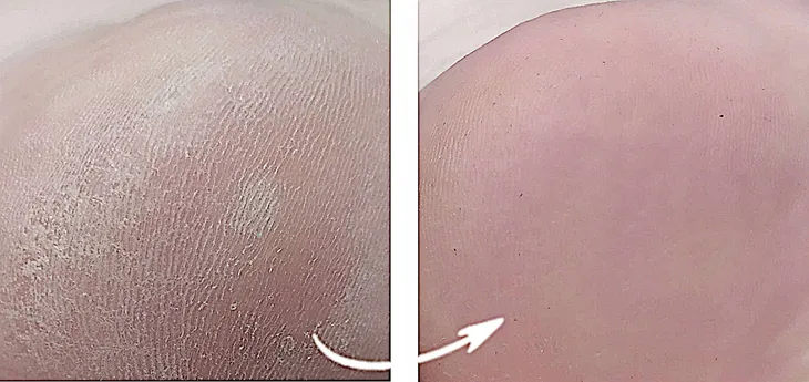 ag-preparat-do-stop-przeciwgrzybiczy-spray-3x100ml-rodzaj-serum