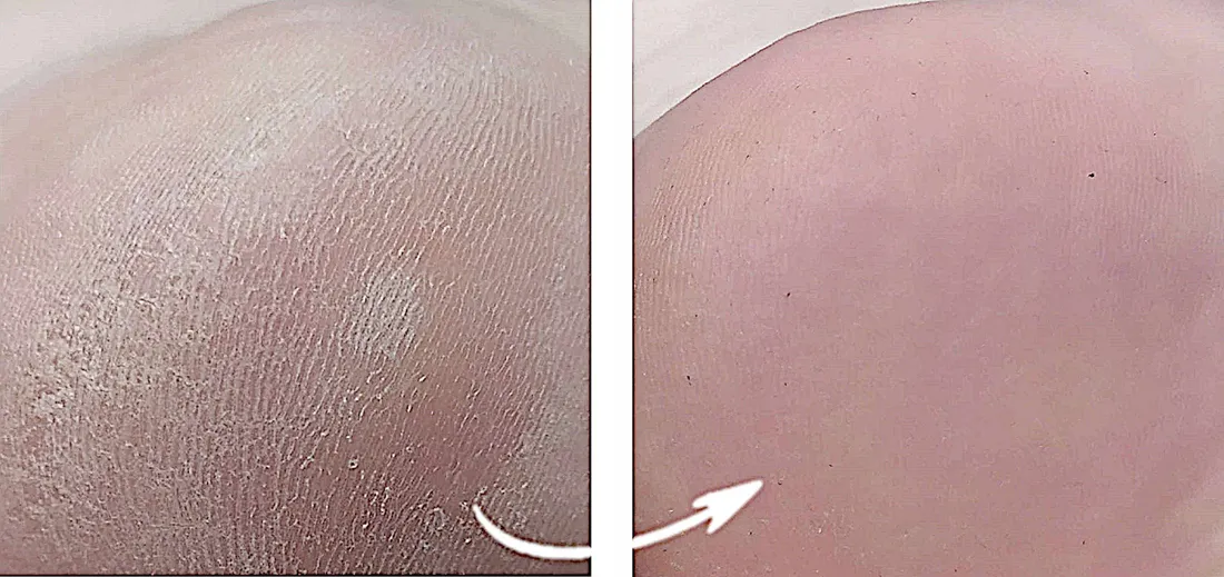 ag-preparat-do-stop-przeciwgrzybiczy-spray-3x100ml