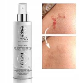 250ml-preparat-nawilzajacy-do-skory-atopowej-egzema-azs