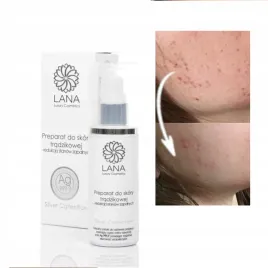 preparat-na-tradzik-przeciwtradzikowy-srebro-100ml