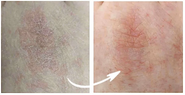 premium-krem-do-rak-ze-srebrem-mocznik-gliceryna-marka-lana