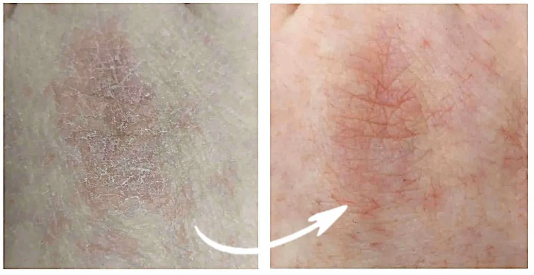 premium-krem-do-rak-ze-srebrem-mocznik-gliceryna