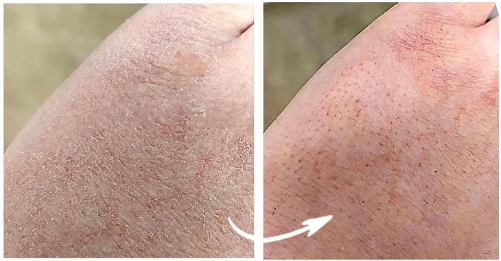 premium-krem-do-rak-ze-srebrem-mocznik-gliceryna-opakowanie-butelka-z-pompka