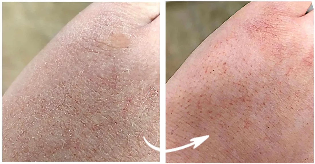 premium-krem-do-rak-ze-srebrem-mocznik-gliceryna