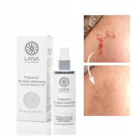 preparat-na-atopowe-zapalenie-skory-azs-srebro-ag
