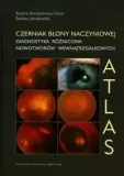 czerniak-blony-naczyniowej-diagnostyka-stan-nowy