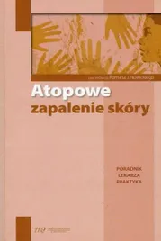 atopowe-zapalenie-skory-poradnik-lekarza-praktyka