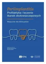 periimplantitis-profilaktyka-i-leczenie-tkanek-okolowszczepowych-gorska