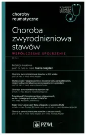choroba-zwyrodnieniowa-stawow