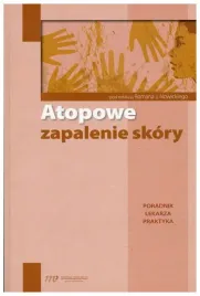 atopowe-zapalenie-skory-poradnik-lekarza-praktyka