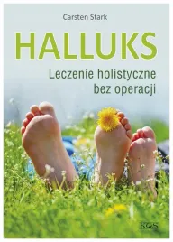 halluks-leczenie-holistyczne-bez-operacji-stark