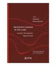metastatic-disease-in-the-liver-current