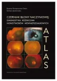 czerniak-blony-naczyniowej-diagnostyka